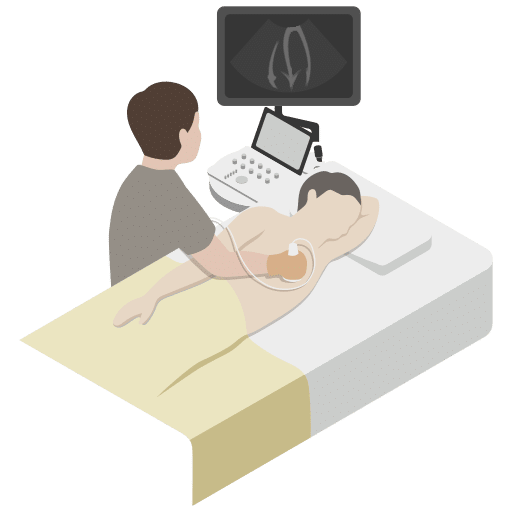 ecografie cardiaca piatra neamt biomedica - ce este ecografia cardiaca